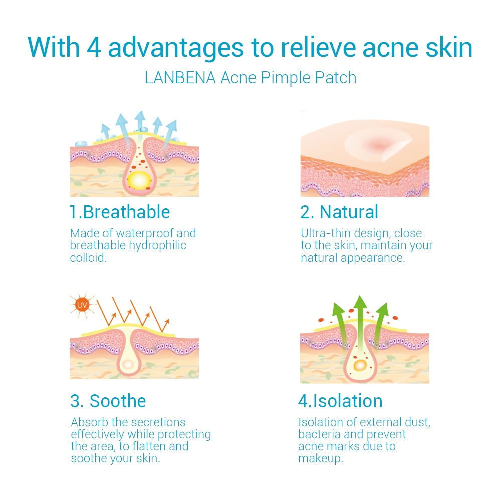 ZitVanish Hydrocolloid Pimple Patches — 28 Count (Tea Tree + Calendula)